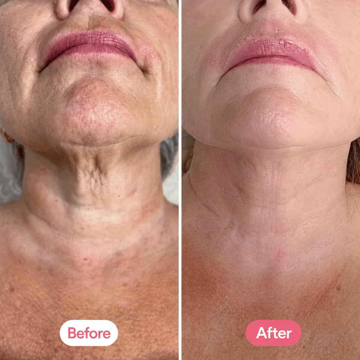 PDRN Neck Cream with Gua Sha Massager