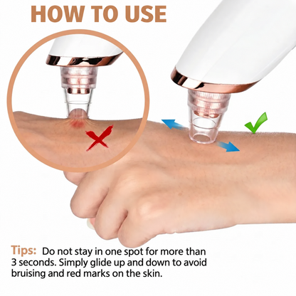 Electric Blackhead Remover